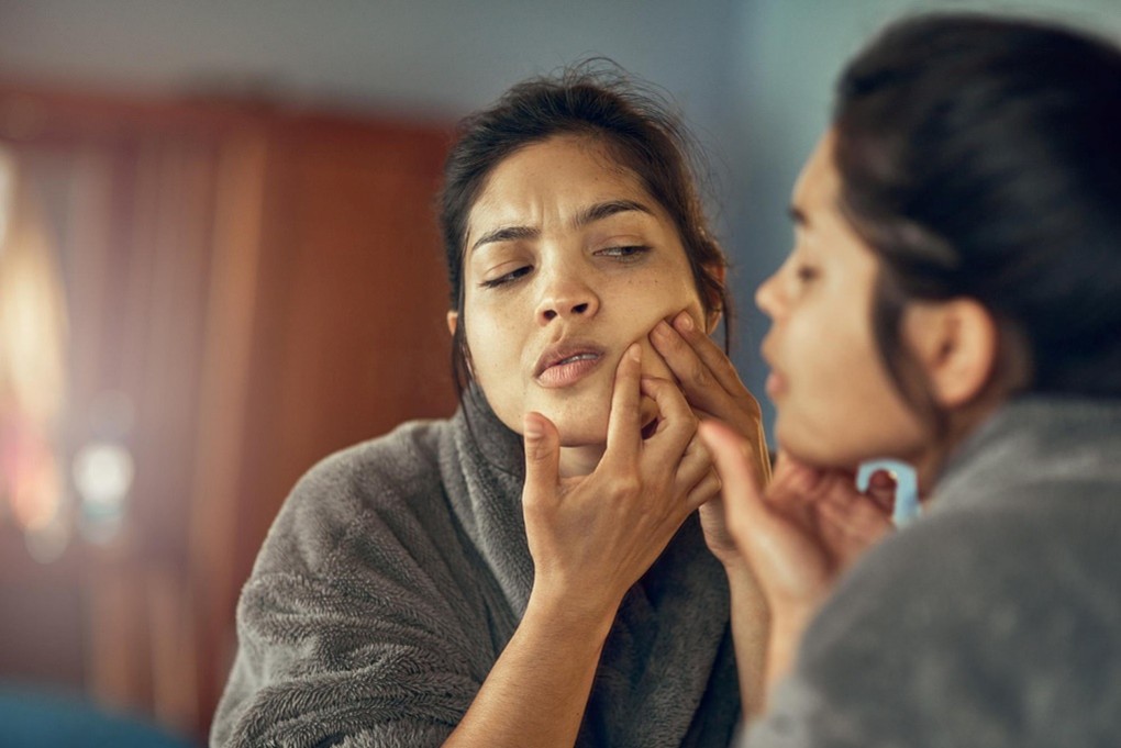 Your Skin Is Talking: What Acne, Dullness, or Dryness Reveal About Inner Health